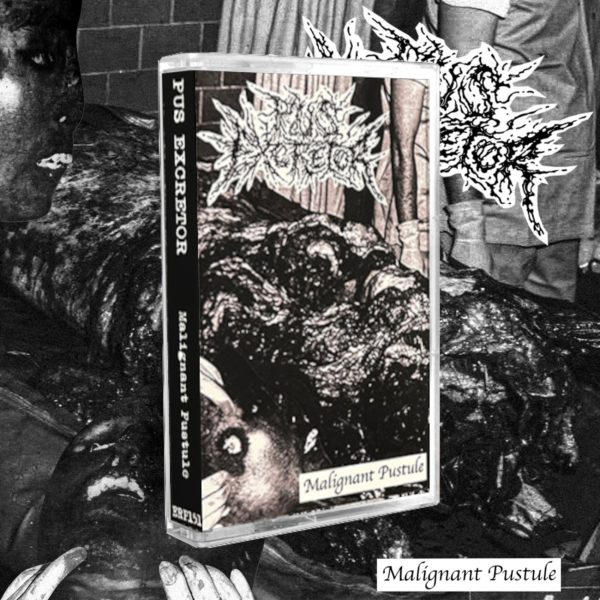 PUS EXCRETOR "Malignant Pustule" CASSETTE (RED SHELL)
